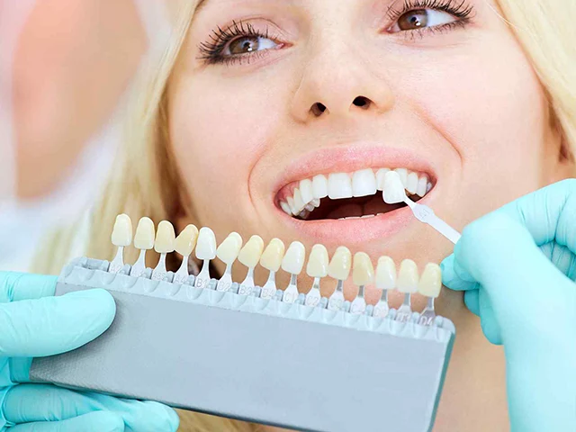 https://www.studiodentisticoramina.it/wp-content/uploads/Sbiancamento-dentale.webp